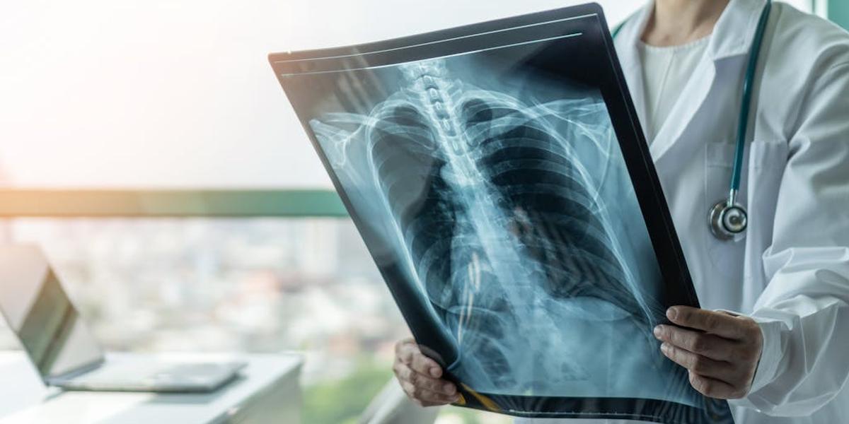 Covid et grippe : cette découverte inquiétante sur les cellules cancéreuses que les médecins redoutaient